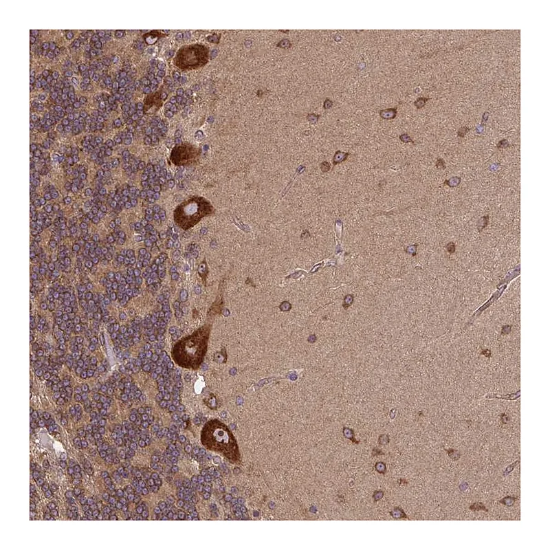 Atlas Antibodies Anti-PLCG1 Antibody
