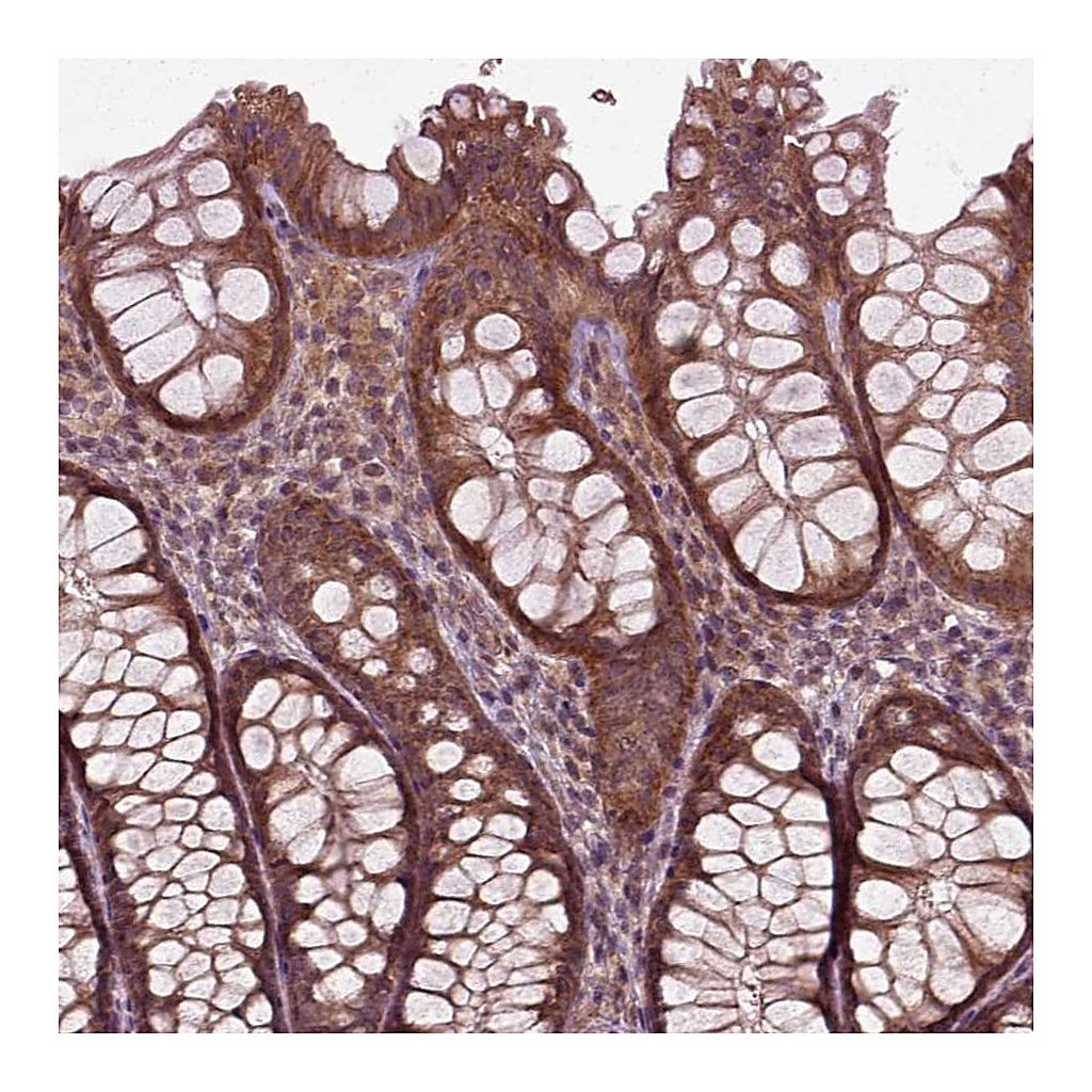 Atlas Antibodies Anti-PLCD3 Antibody