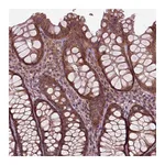 Atlas Antibodies Anti-PLCD3 Antibody