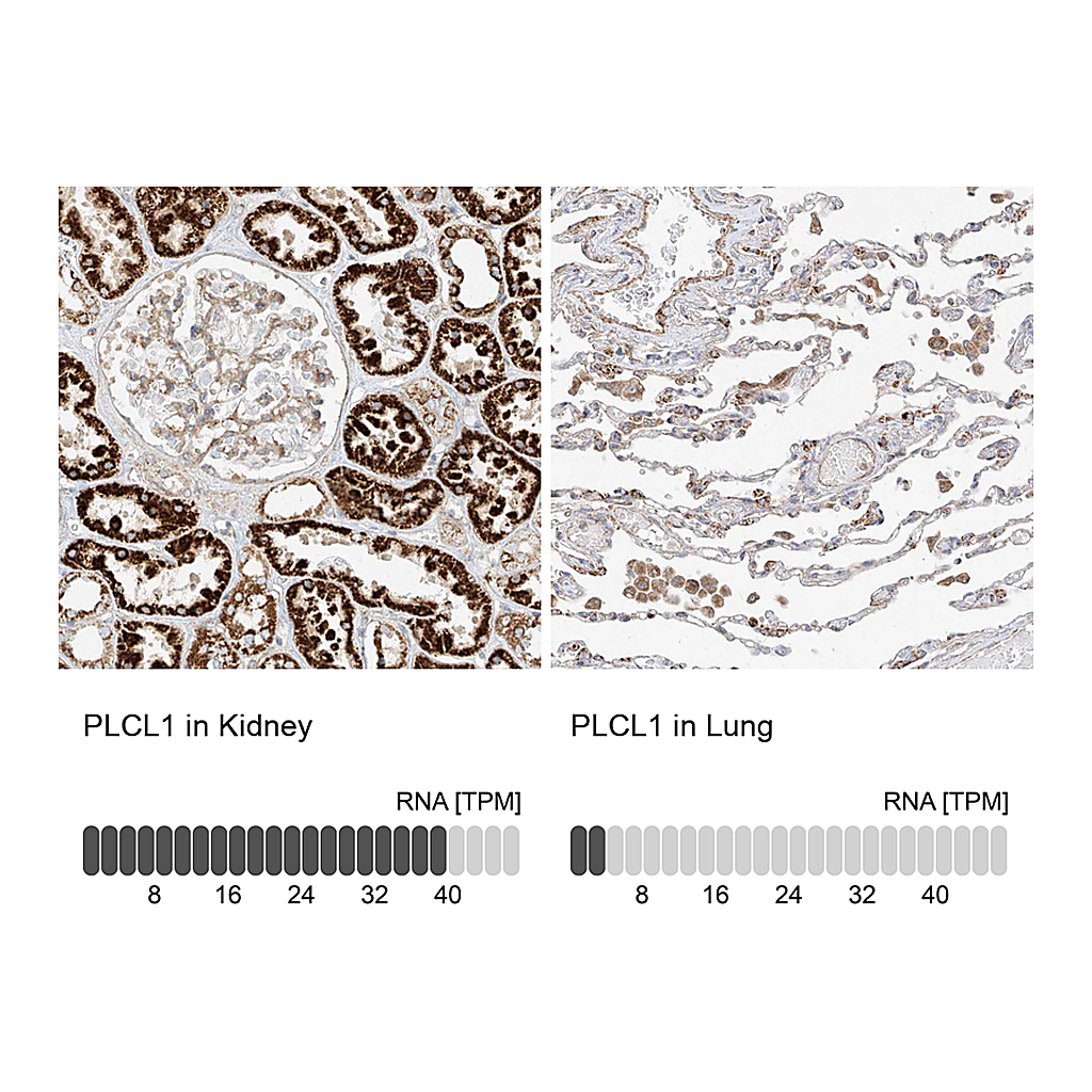 Atlas Antibodies Anti-PLCL1 Antibody