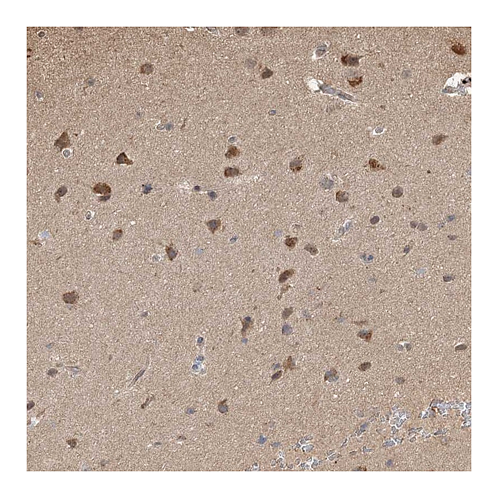 Atlas Antibodies Anti-PLCH1 Antibody
