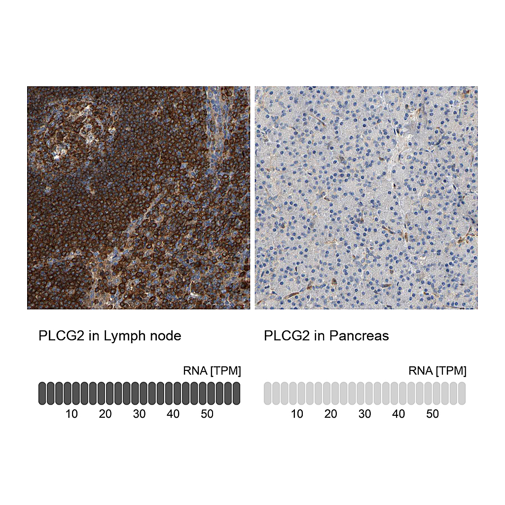 Atlas Antibodies Anti-PLCG2 Antibody