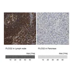 Atlas Antibodies Anti-PLCG2 Antibody