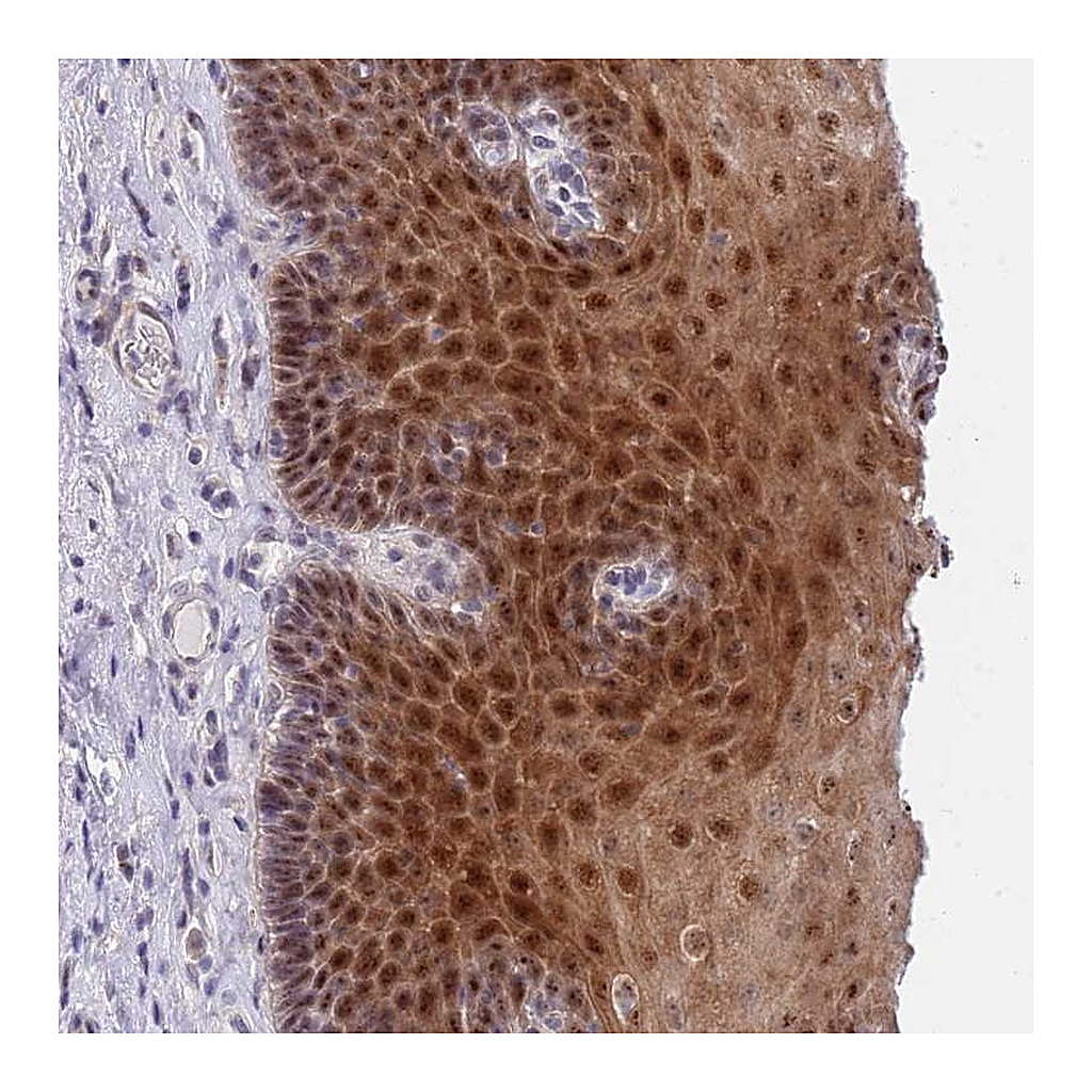 Atlas Antibodies Anti-PLCL2 Antibody