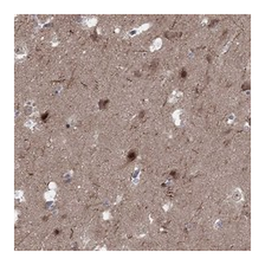 Atlas Antibodies Anti-PLCL2 Antibody