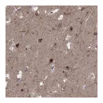 Atlas Antibodies Anti-PLCL2 Antibody