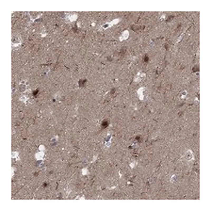 Atlas Antibodies Anti-PLCL2 Antibody