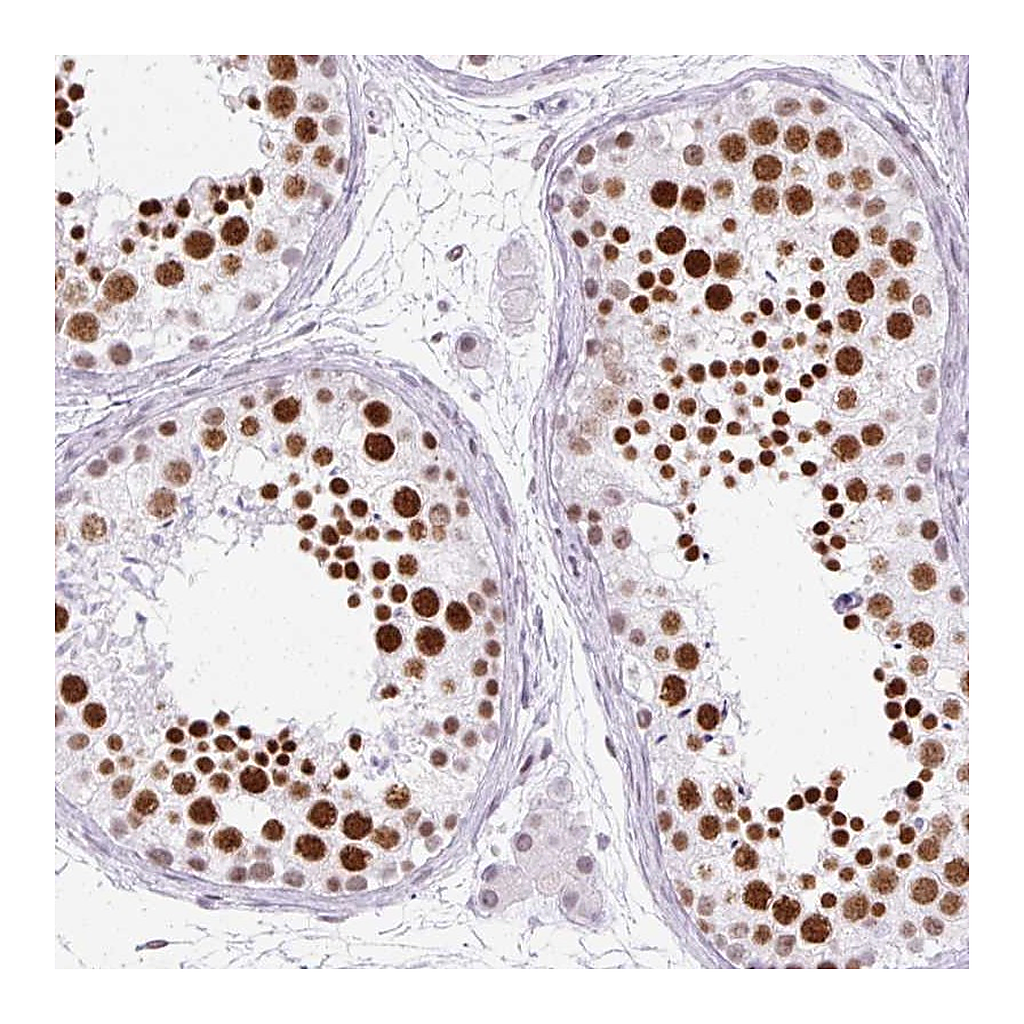 Atlas Antibodies Anti-PLCXD2 Antibody