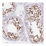 Atlas Antibodies Anti-PLCXD2 Antibody