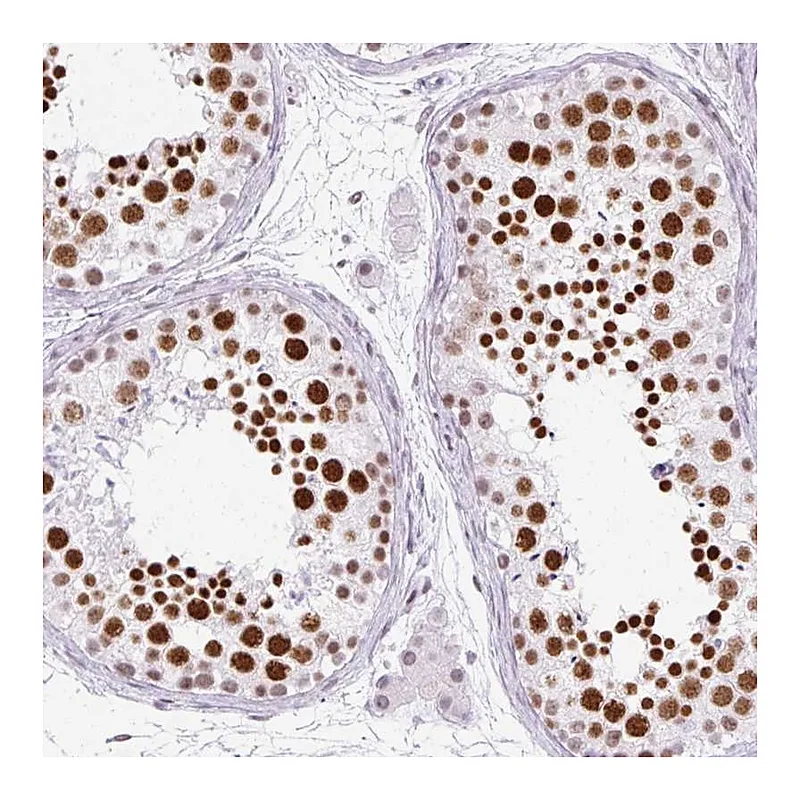 Atlas Antibodies Anti-PLCXD2 Antibody