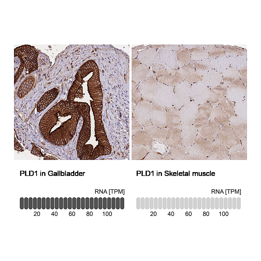 Atlas Antibodies Anti-PLD1 Antibody