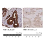 Atlas Antibodies Anti-PLD1 Antibody