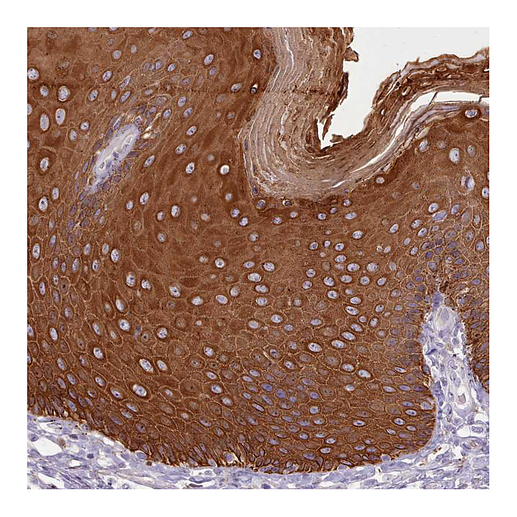 Atlas Antibodies Anti-PLD4 Antibody