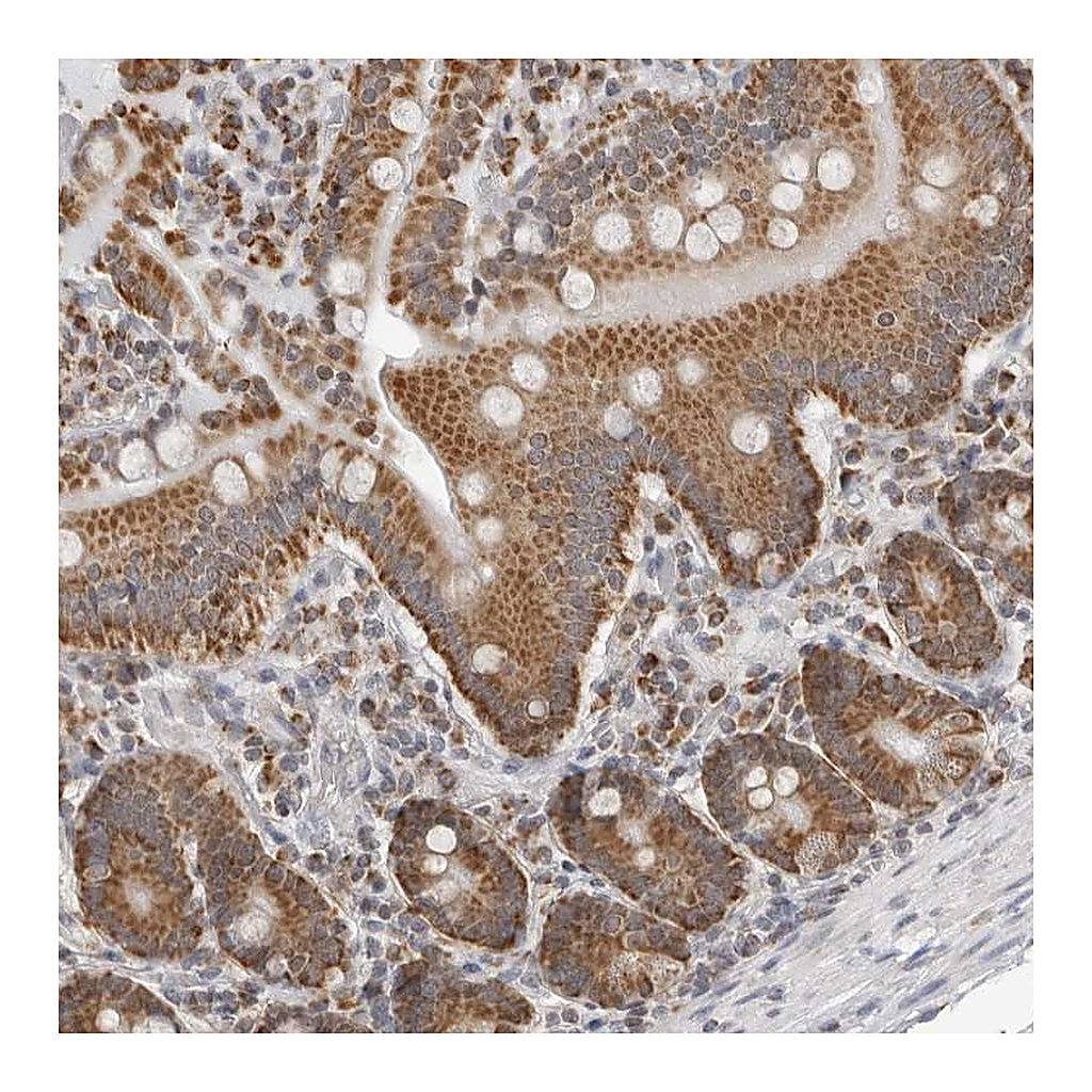 Atlas Antibodies Anti-PLD5 Antibody