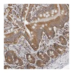 Atlas Antibodies Anti-PLD5 Antibody