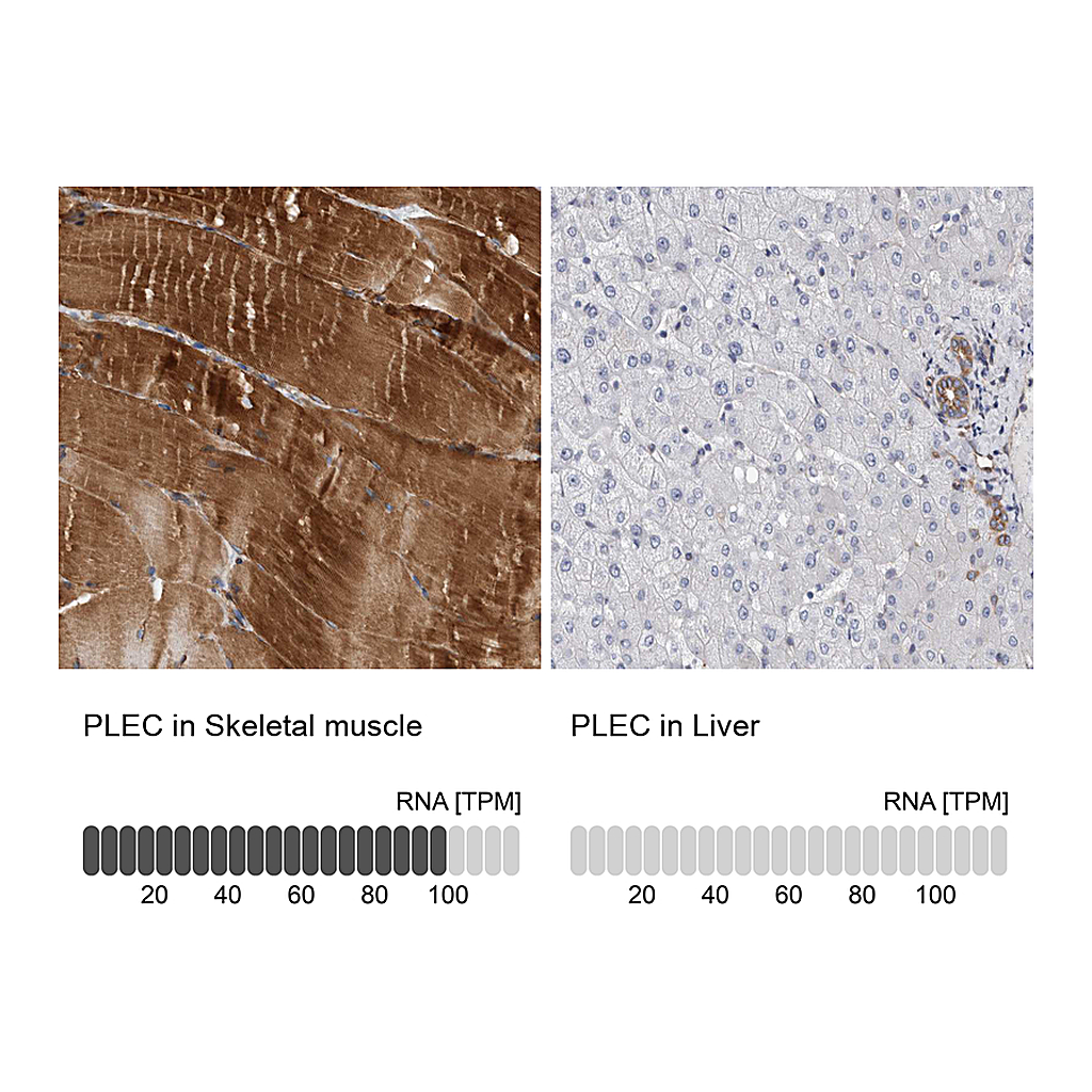 Atlas Antibodies Anti-PLEC Antibody