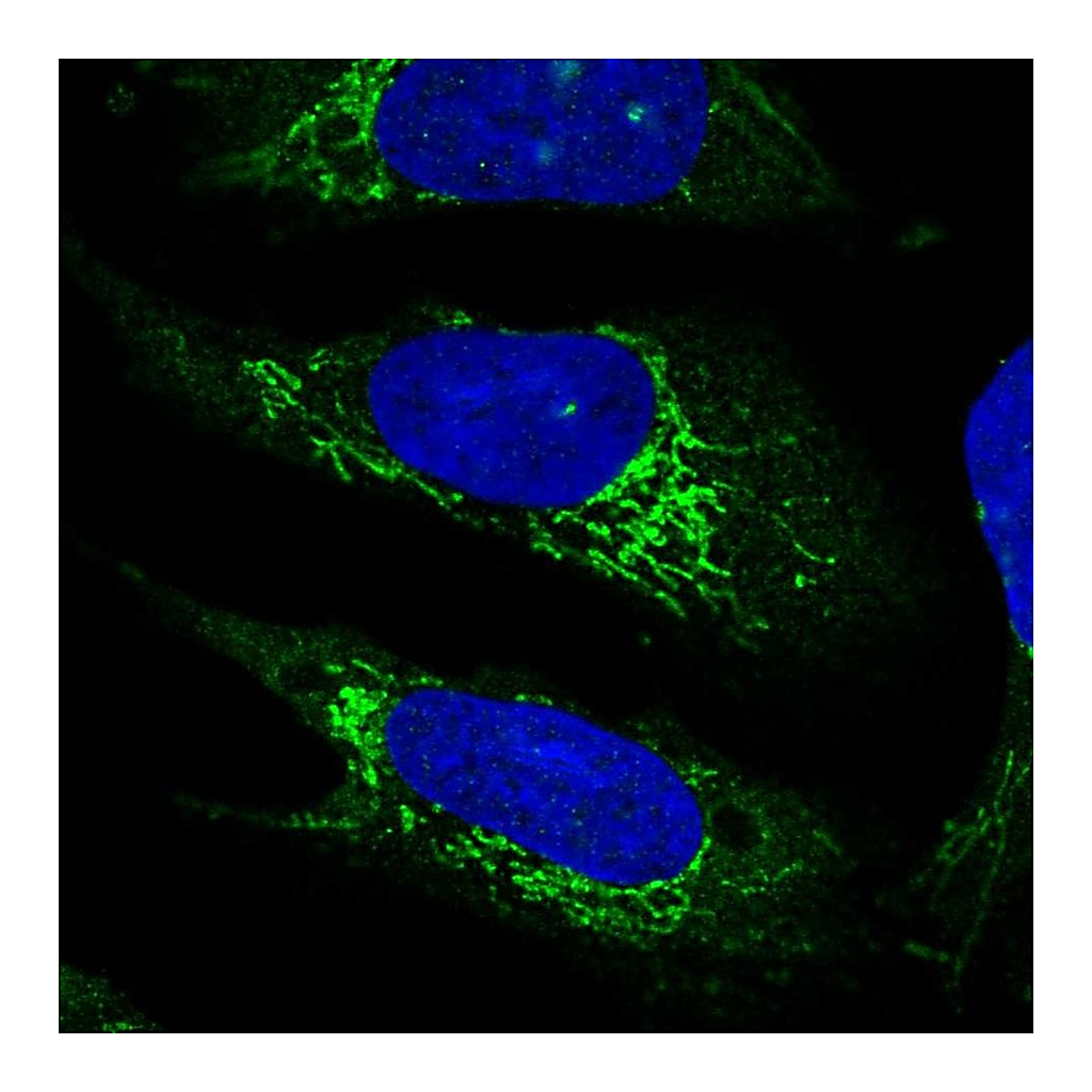 Atlas Antibodies Anti-PLD5 Antibody
