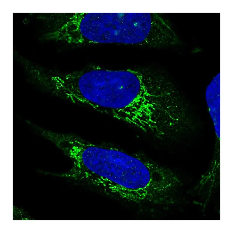 Atlas Antibodies Anti-PLD5 Antibody