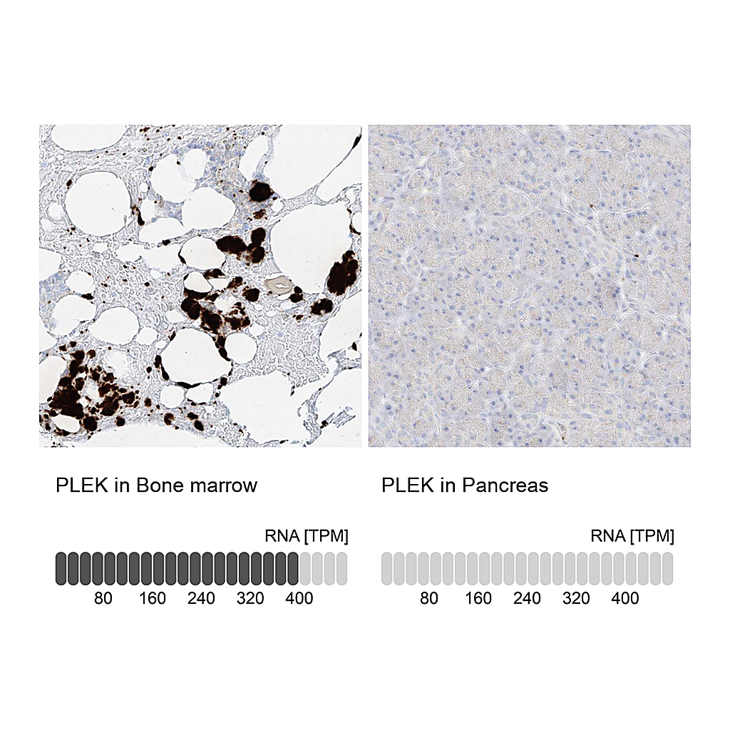 Atlas Antibodies Anti-PLEK Antibody