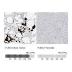 Atlas Antibodies Anti-PLEK Antibody