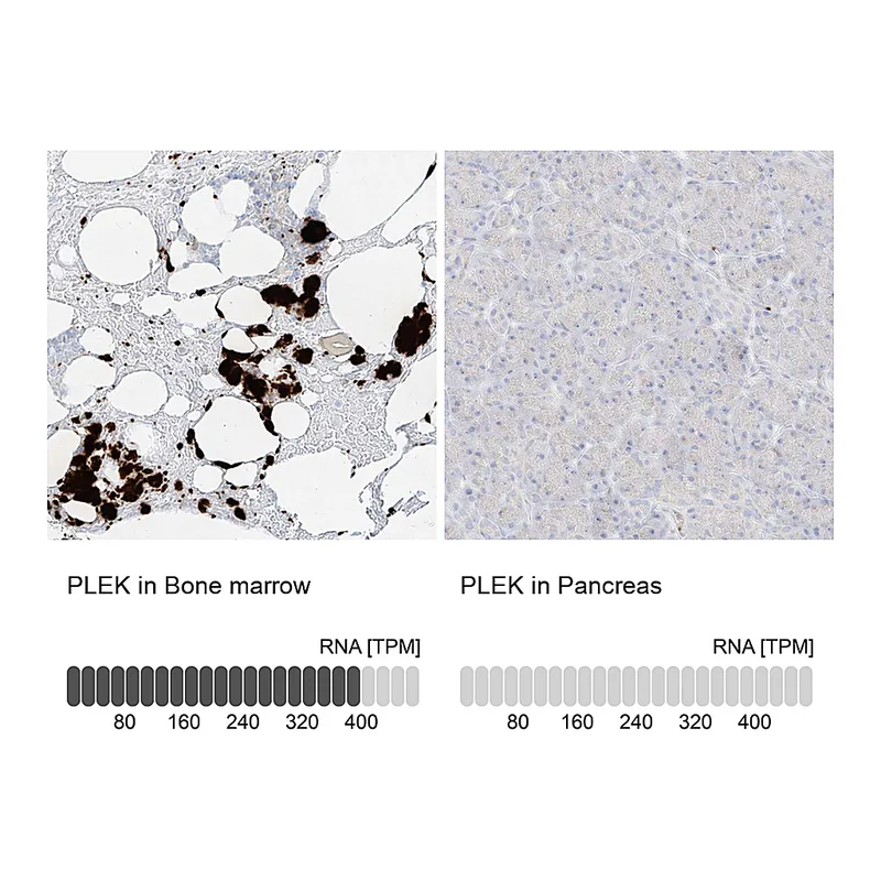 Atlas Antibodies Anti-PLEK Antibody