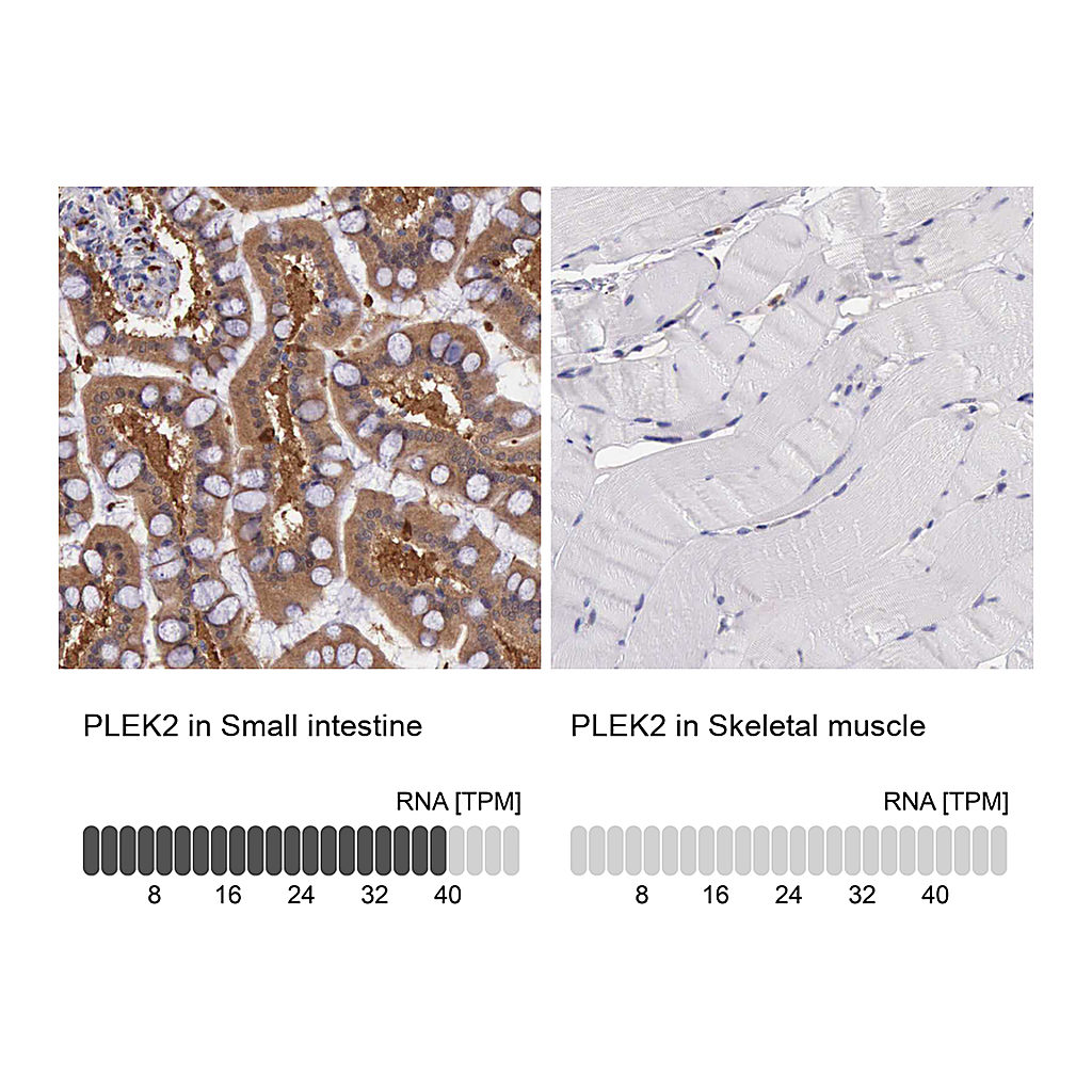 Atlas Antibodies Anti-PLEK2 Antibody