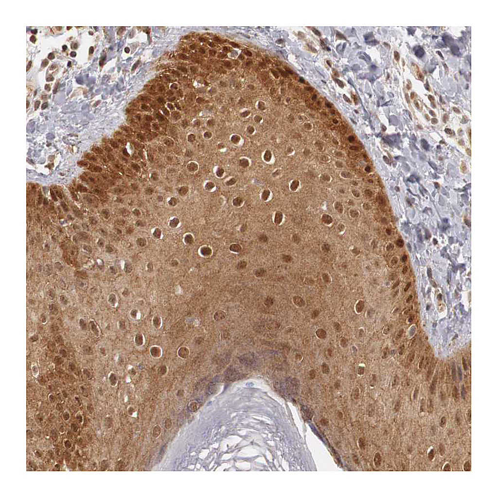 Atlas Antibodies Anti-PLEKHA1 Antibody