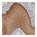 Atlas Antibodies Anti-PLEKHA1 Antibody
