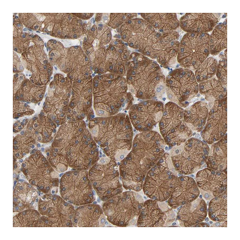 Atlas Antibodies Anti-PLEKHA2 Antibody
