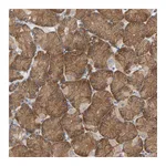 Atlas Antibodies Anti-PLEKHA2 Antibody
