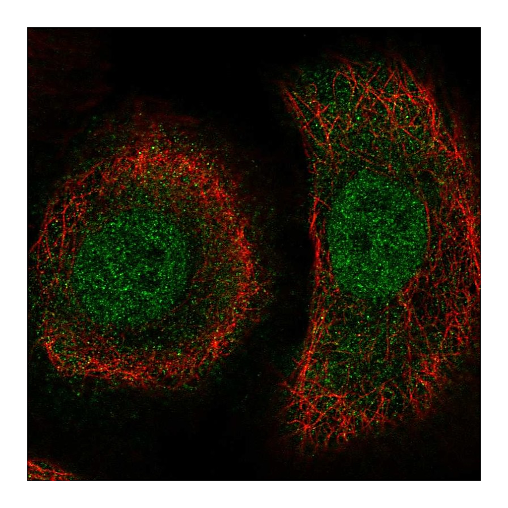 Atlas Antibodies Anti-PLEKHA1 Antibody