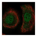 Atlas Antibodies Anti-PLEKHA1 Antibody