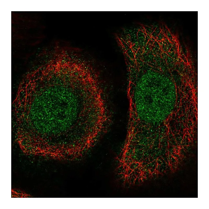 Atlas Antibodies Anti-PLEKHA1 Antibody