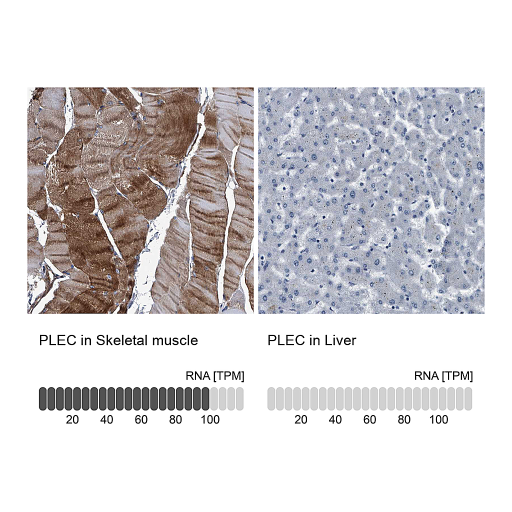 Atlas Antibodies Anti-PLEC Antibody