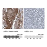 Atlas Antibodies Anti-PLEC Antibody