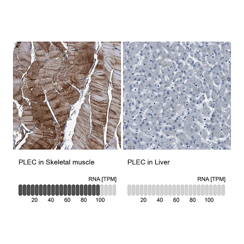 Atlas Antibodies Anti-PLEC Antibody