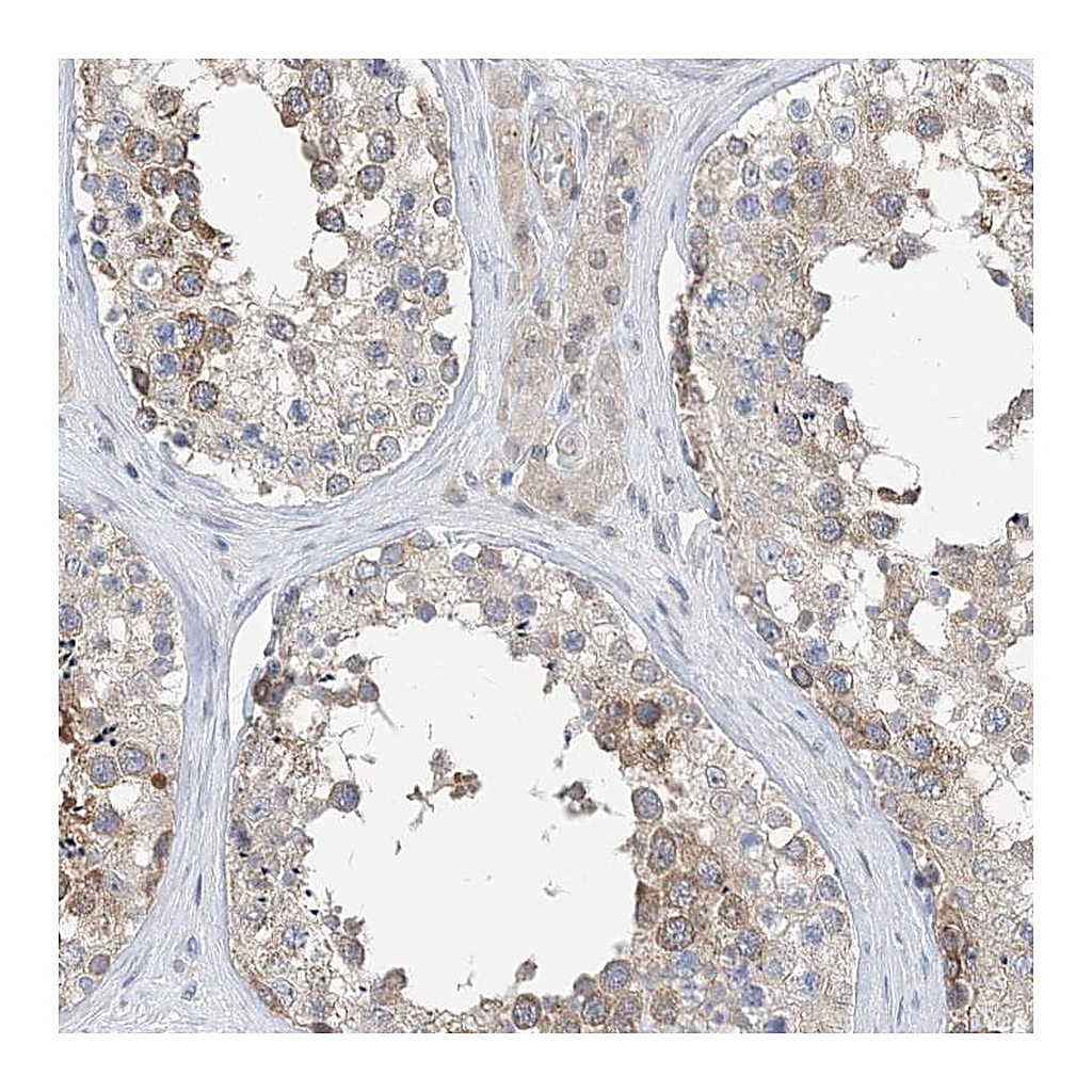 Atlas Antibodies Anti-PLEKHA3 Antibody
