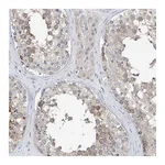 Atlas Antibodies Anti-PLEKHA3 Antibody
