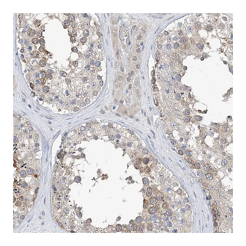 Atlas Antibodies Anti-PLEKHA3 Antibody
