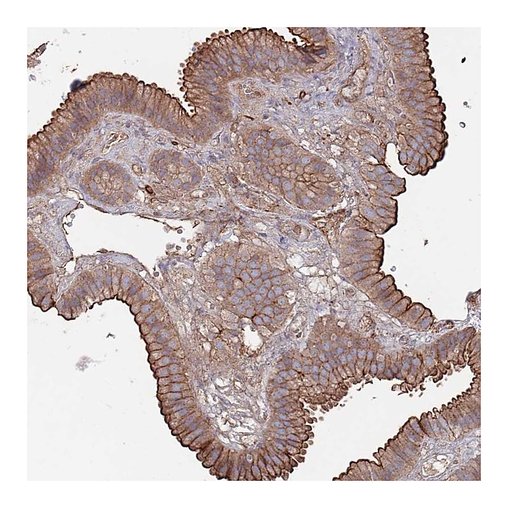 Atlas Antibodies Anti-PLEKHA4 Antibody