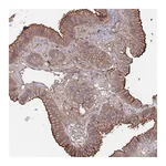 Atlas Antibodies Anti-PLEKHA4 Antibody