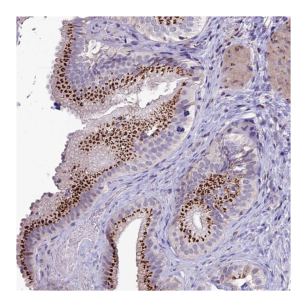 Atlas Antibodies Anti-PLEKHA4 Antibody