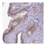 Atlas Antibodies Anti-PLEKHA4 Antibody