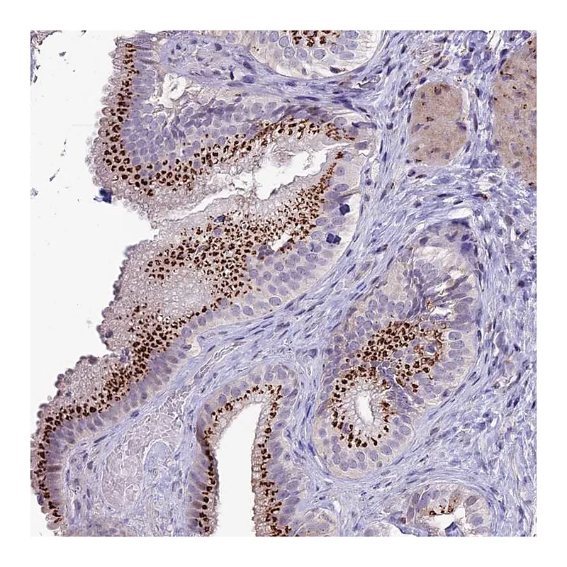 Atlas Antibodies Anti-PLEKHA4 Antibody