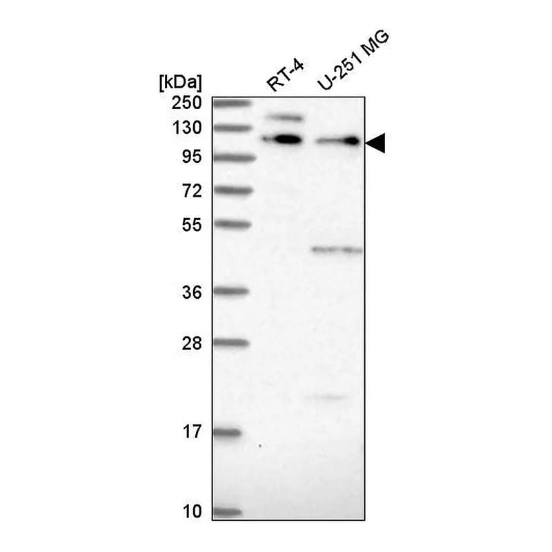Atlas Antibodies Anti-PLEKHA5 Antibody