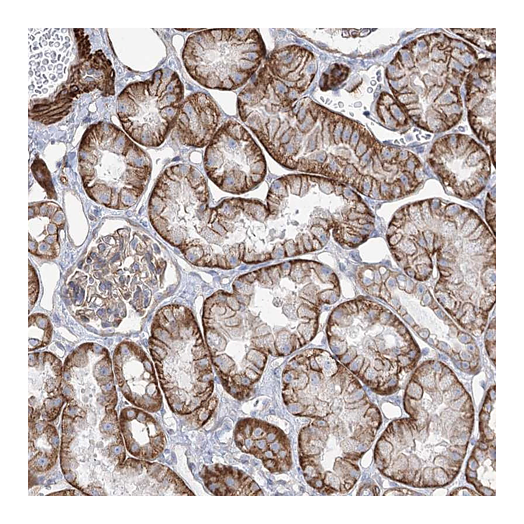 Atlas Antibodies Anti-PLEKHA5 Antibody