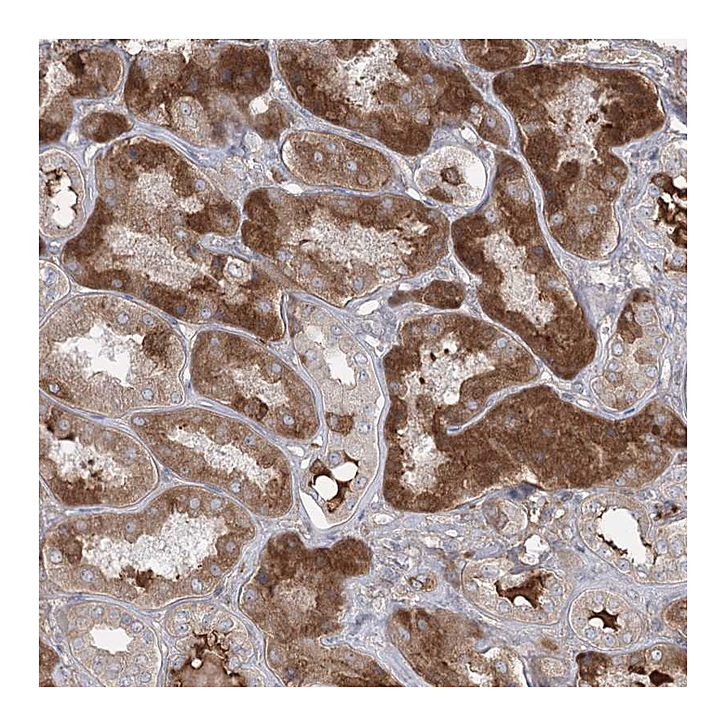 Atlas Antibodies Anti-PLEKHA5 Antibody