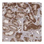 Atlas Antibodies Anti-PLEKHA5 Antibody