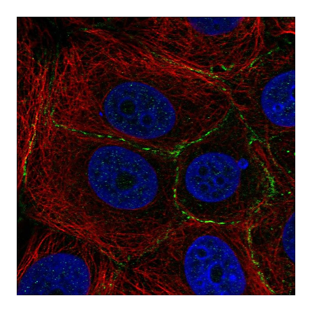 Atlas Antibodies Anti-PLEKHA6 Antibody