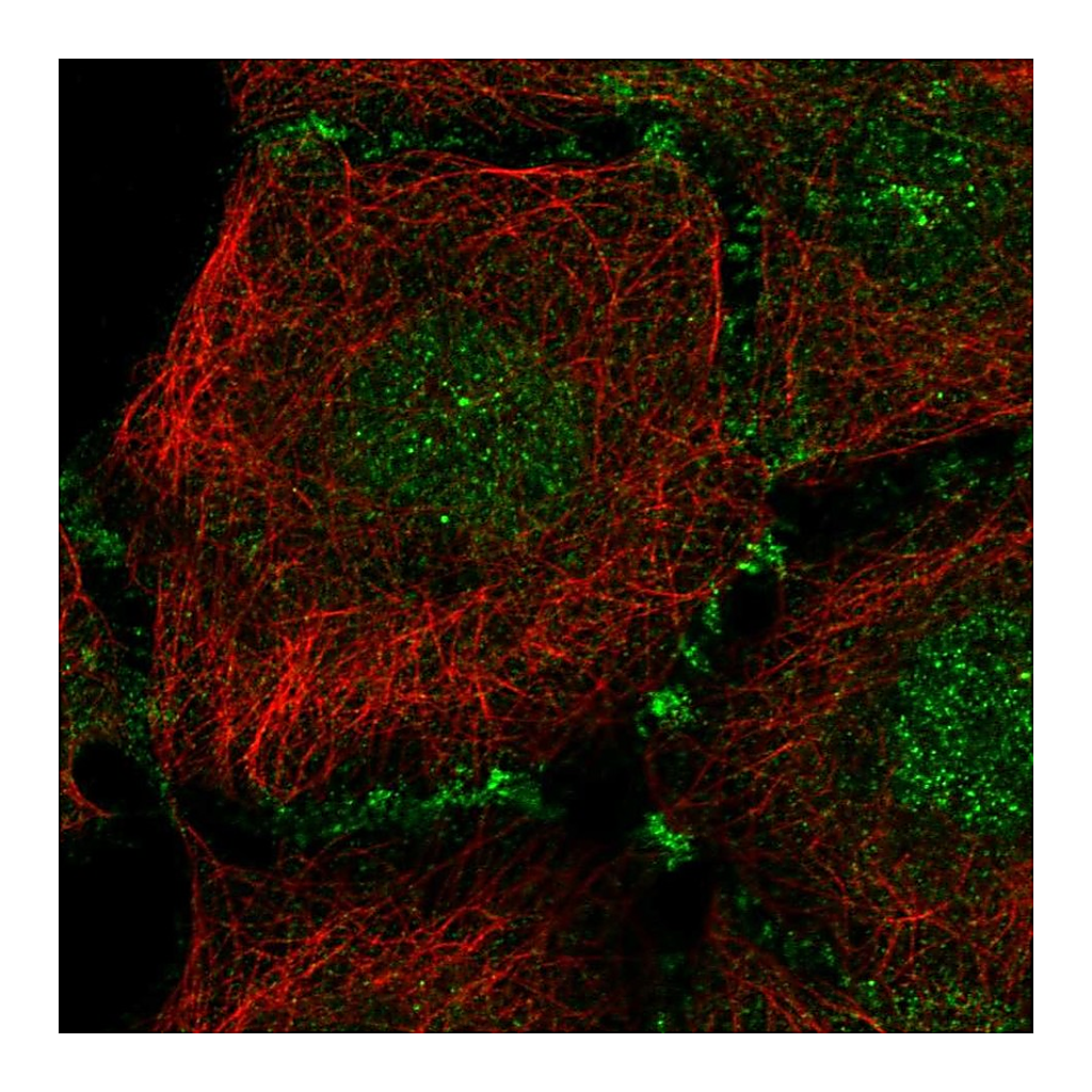 Atlas Antibodies Anti-PLEKHA7 Antibody